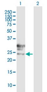 TMEM27 Antibody in Western Blot (WB)