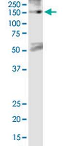 XPO5 Antibody in Western Blot (WB)