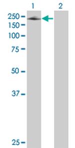 SEMA6A Antibody in Western Blot (WB)