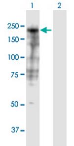 SHROOM3 Antibody in Western Blot (WB)