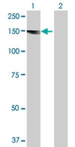 ALS2 Antibody in Western Blot (WB)