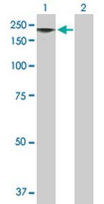 MAGEE1 Antibody in Western Blot (WB)