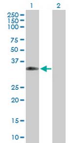 CPNE5 Antibody in Western Blot (WB)