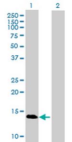 GBA3 Antibody in Western Blot (WB)