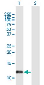 LSM2 Antibody in Western Blot (WB)