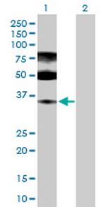 ENOPH1 Antibody in Western Blot (WB)