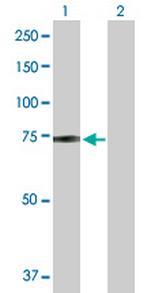 ZBED5 Antibody in Western Blot (WB)