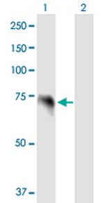 IL22RA1 Antibody in Western Blot (WB)