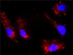 IL21 Antibody in Proximity Ligation Assay (PLA) (PLA)