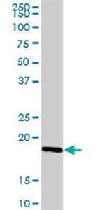 IL21 Antibody in Western Blot (WB)