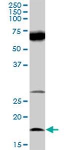 IL21 Antibody in Western Blot (WB)