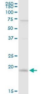 IL21 Antibody in Western Blot (WB)