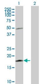 IL21 Antibody in Western Blot (WB)