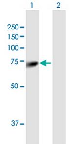 ALOXE3 Antibody in Western Blot (WB)