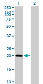 PPCDC Antibody in Western Blot (WB)