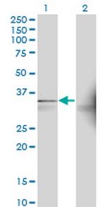 AASDHPPT Antibody in Western Blot (WB)