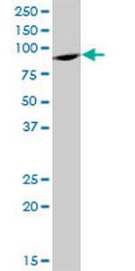 ELAC2 Antibody in Western Blot (WB)