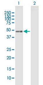 MIIP Antibody in Western Blot (WB)