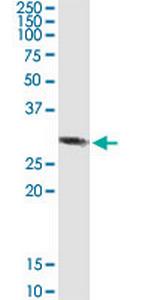 RBKS Antibody in Western Blot (WB)