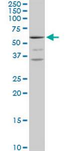 MCCC2 Antibody in Western Blot (WB)