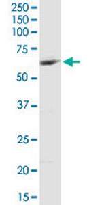 MCCC2 Antibody in Western Blot (WB)