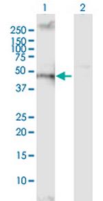 VSIR Antibody in Western Blot (WB)