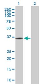 FN3K Antibody in Western Blot (WB)