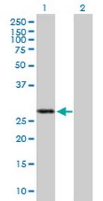 IFIH1 Antibody in Western Blot (WB)