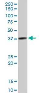 TFB2M Antibody in Western Blot (WB)