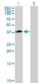 TFB2M Antibody in Western Blot (WB)