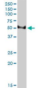 TFB2M Antibody in Western Blot (WB)