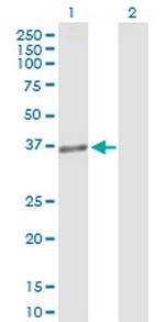 MLST8 Antibody in Western Blot (WB)