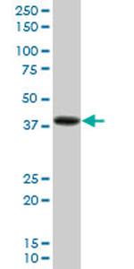 PDLIM2 Antibody in Western Blot (WB)