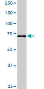 HHIP Antibody in Western Blot (WB)