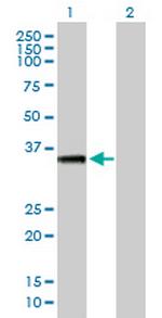 AKTIP Antibody in Western Blot (WB)