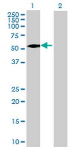 ALDH8A1 Antibody in Western Blot (WB)