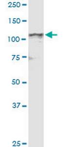 NDST4 Antibody in Western Blot (WB)