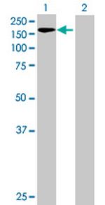 ZNF574 Antibody in Western Blot (WB)