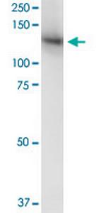 MICAL1 Antibody in Western Blot (WB)