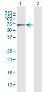 RBM15 Antibody in Western Blot (WB)