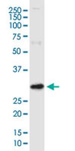 ARV1 Antibody in Western Blot (WB)