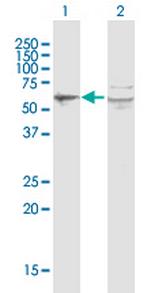 PORCN Antibody in Western Blot (WB)