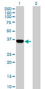 C1orf80 Antibody in Western Blot (WB)