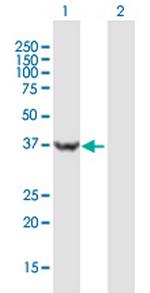 USP46 Antibody in Western Blot (WB)