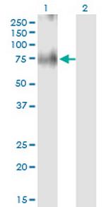 SLC30A5 Antibody in Western Blot (WB)