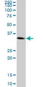 CENPH Antibody in Western Blot (WB)