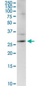 CENPH Antibody in Western Blot (WB)