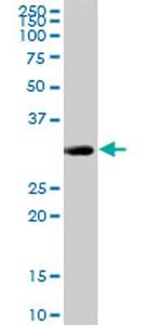 CENPH Antibody in Western Blot (WB)