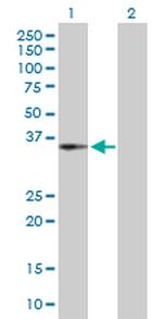 CENPH Antibody in Western Blot (WB)