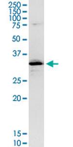 CENPH Antibody in Western Blot (WB)